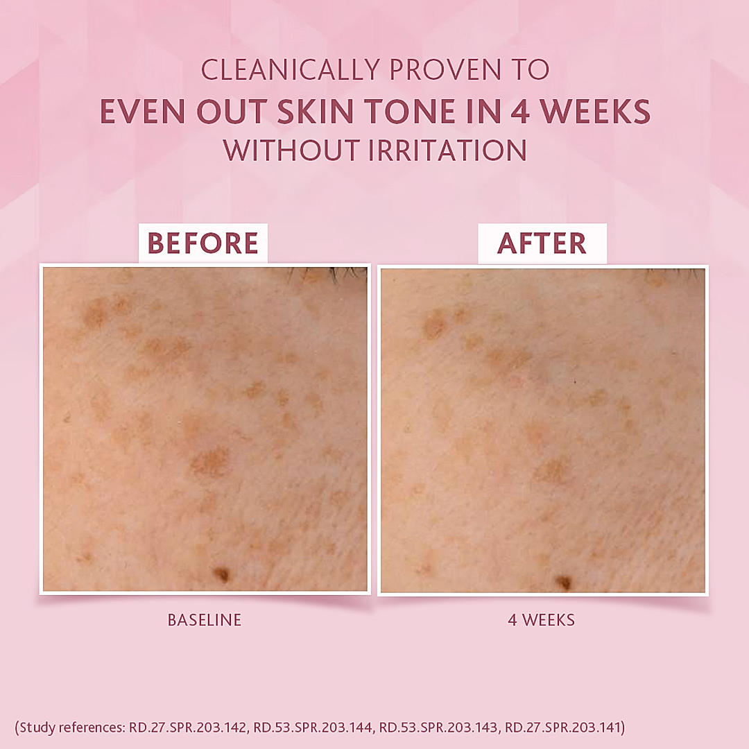 Cetaphil Bright Healthy Radiance Brightening Day Protection Cream with Niacinamide | Reduces Dark Spots, 50gm6