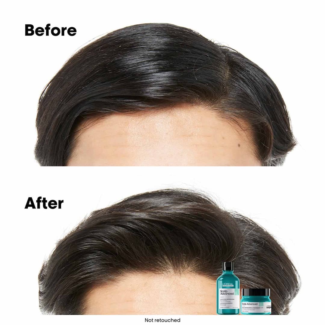 L'Oreal  Professionnel Paris Scalp Advanced Anti-Gras Oiliness Mask, 250ml12