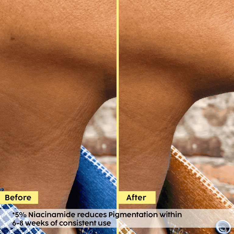 Plix Pineapple Bright Polishing Cream for Dark Underarms & Even-Toned Skin, 50g