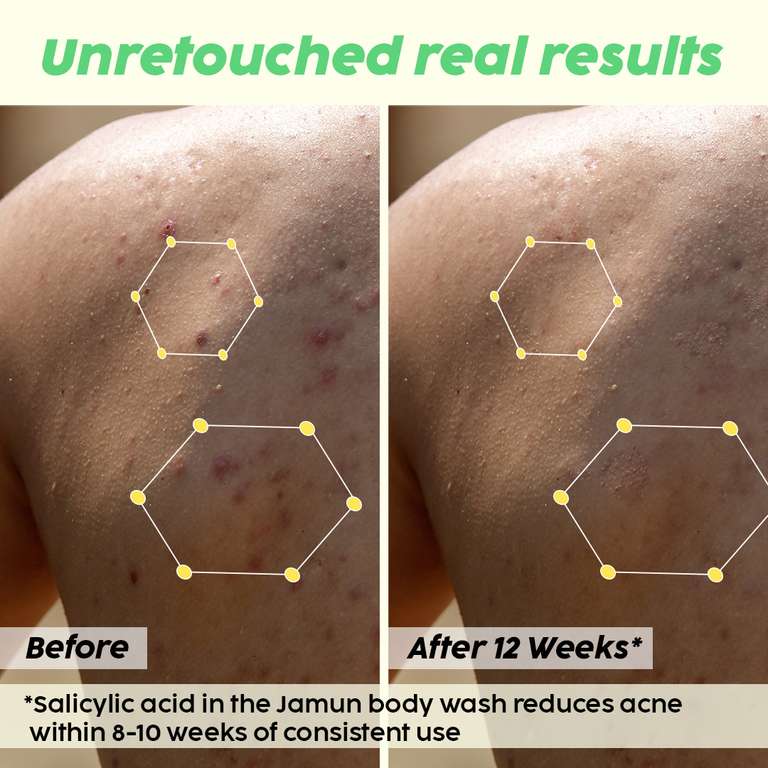 Plix Jamun 2% Salicylic Acid Body Wash For Body Acne, Bumpy Skin, 236ml | For All Skin Types