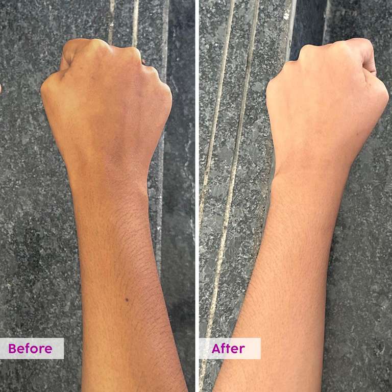 Plix Pineapple 5% Lactic Acid Exfoliating Body Wash, 236ml | For Tan Free & Brighter Skin